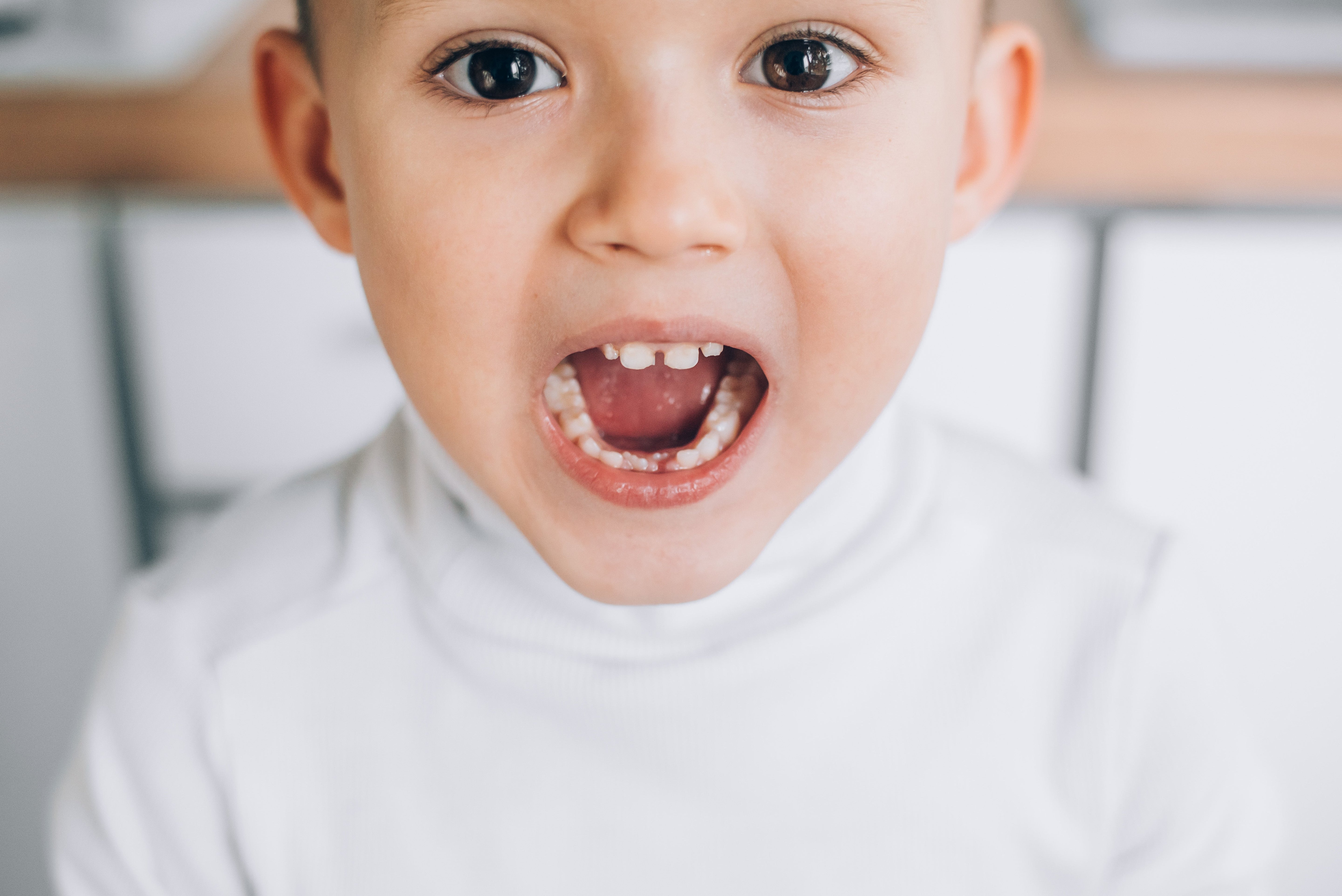 Noticed Your Baby's Teeth Are Crooked